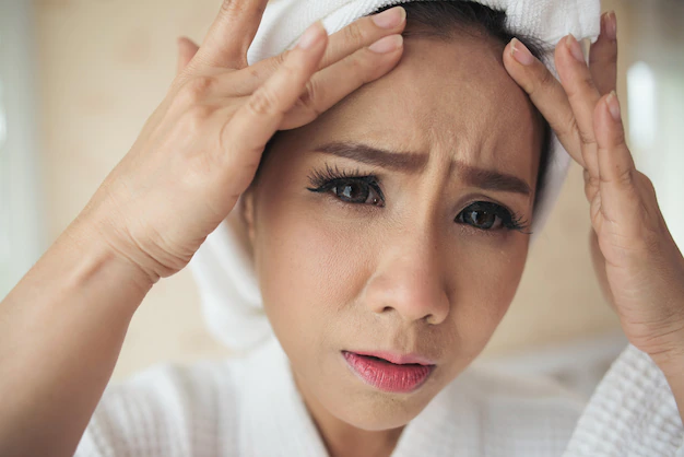 Punca Jerawat Di Dahi dan Cara Menangani Secara Lembut