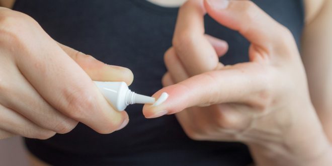 7 Obat Totol Jerawat dan Bekasnya Paling Ampuh